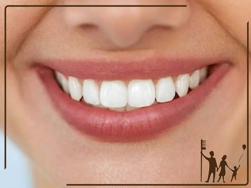 نقش فرم لب در طراحی لبخند