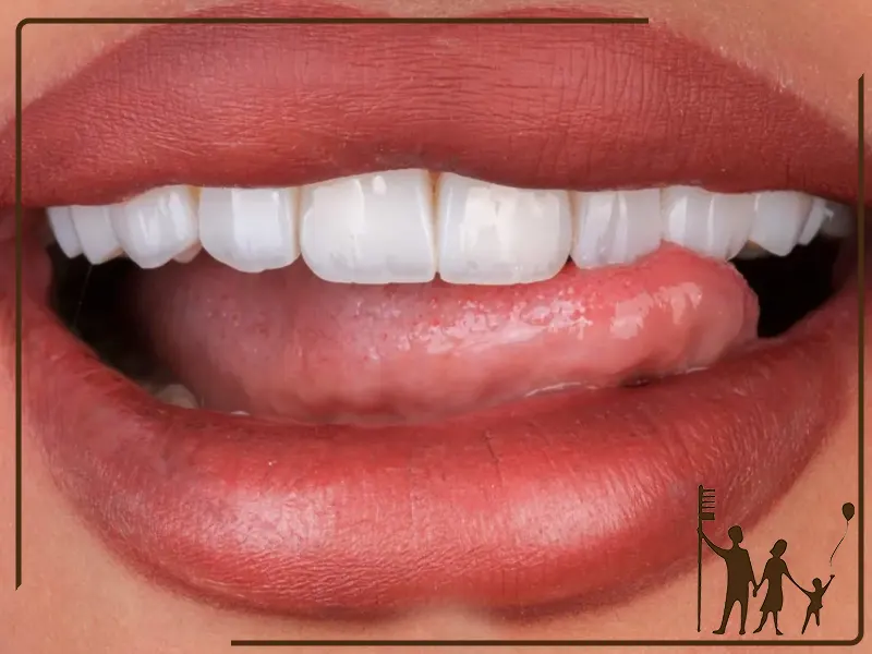 تفاوت کامپوزیت معمولی با کامپوزیت میکروسکوپی