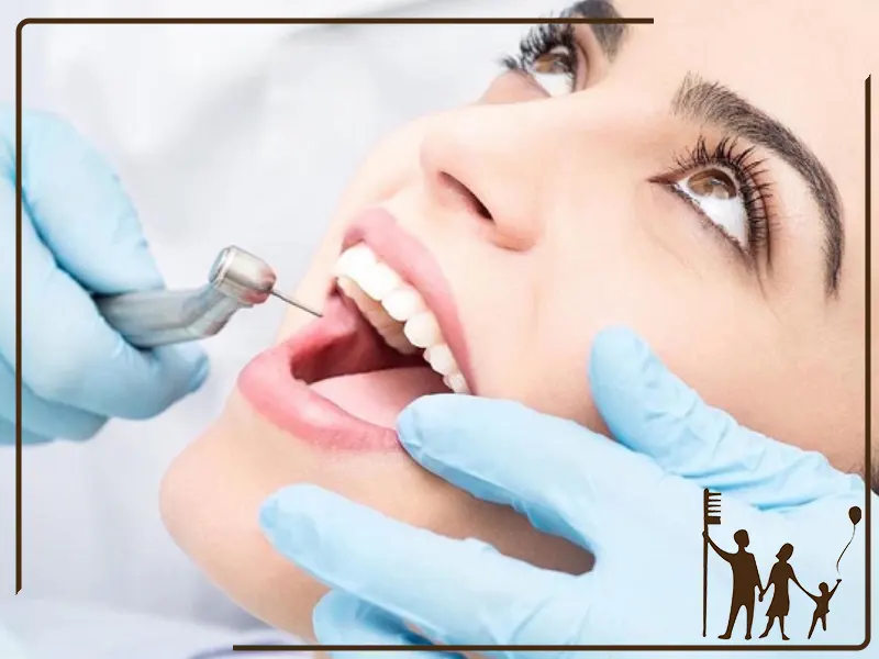 مراقبت‌های بعد از کامپوزیت دندان تحت میکروسکوپ