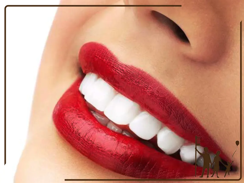 راهکارهای افزایش ماندگاری بلیچینگ