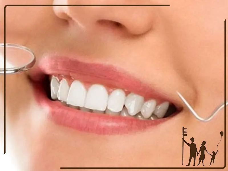 چند جلسه برای سفید کردن دندان‌ها لازم است؟