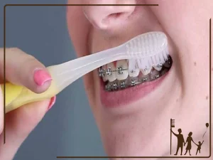 مراقبت های ارتودنسی